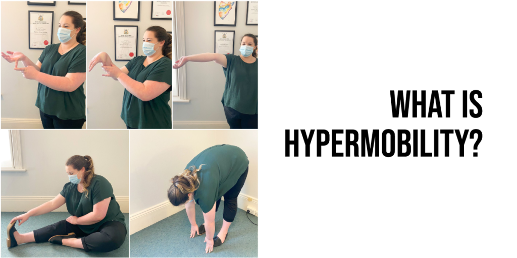 What is Hypermobility?