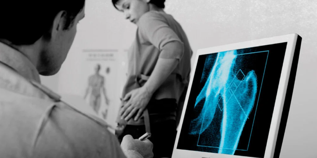 The Key DXA Scan Benefits